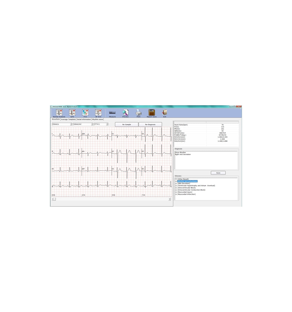 ECG PC Numérique SE-1010 Edan