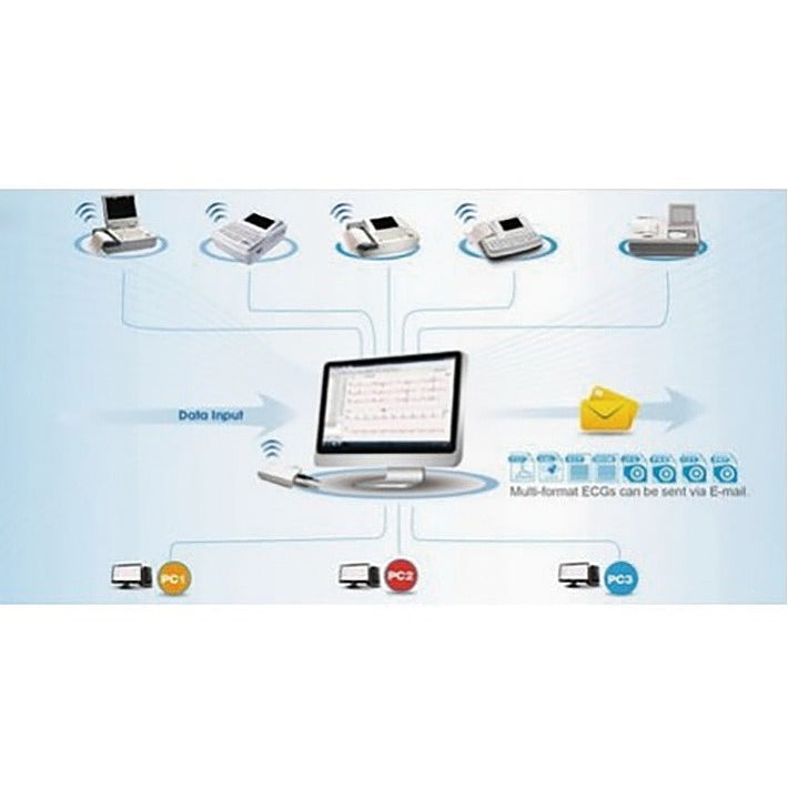 Slimme ECG-viewersoftware voor ECG SE-301 (Edan)