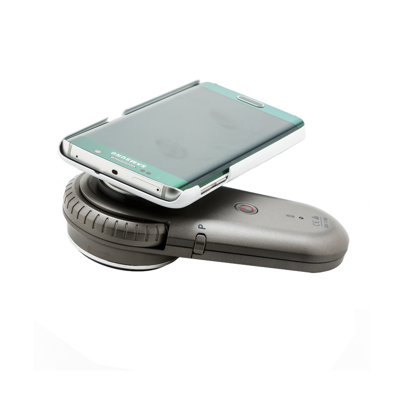 ILLUCO IDS-1100 Oplaadbare Dermatoscoop
