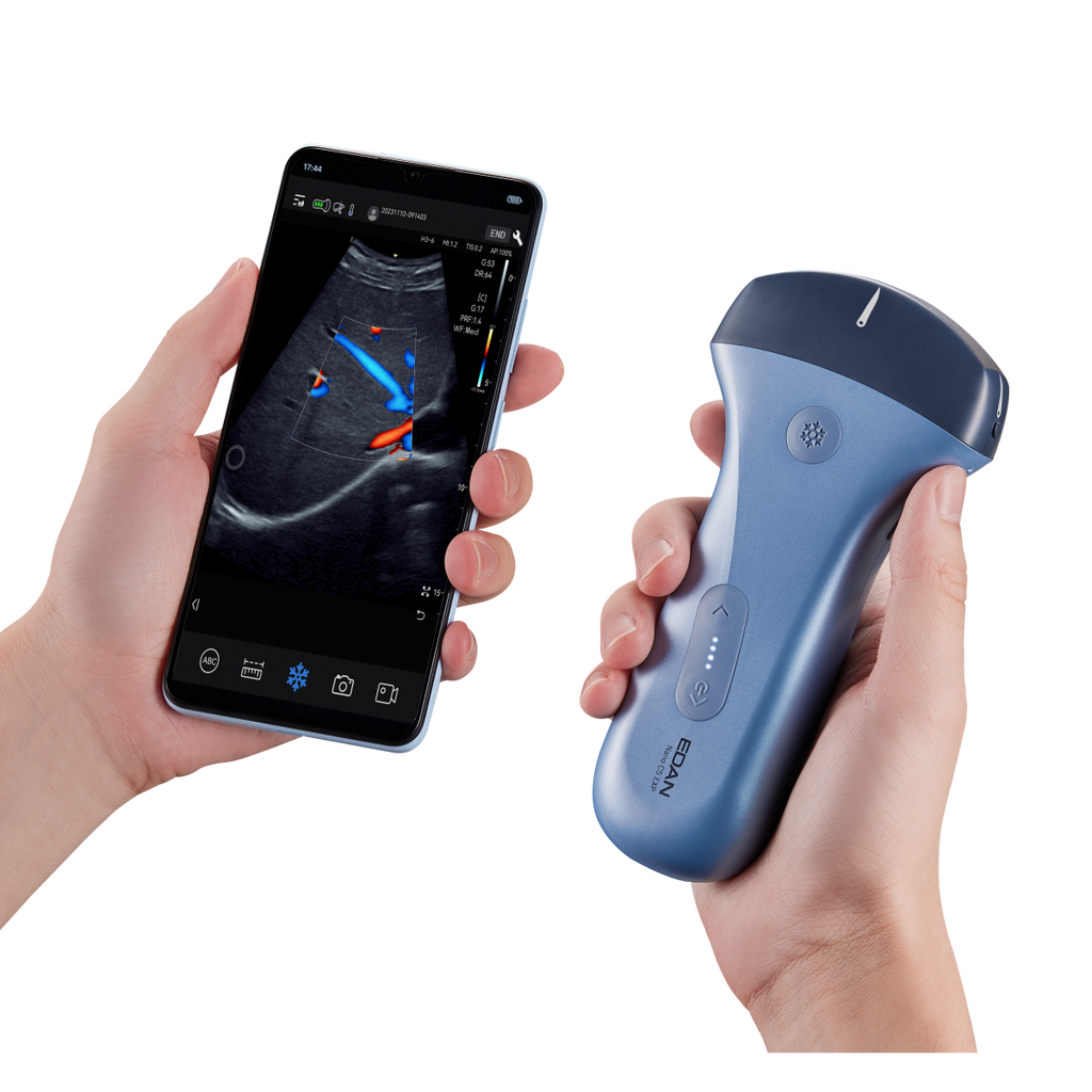 Edan Nano Convex draagbare kleuren-echografie scanner