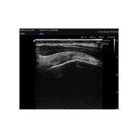 Edan Nano Lineaire Draagbare Kleuren Ultrasound Scanner