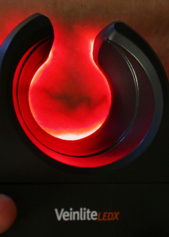 Veinlite LEDX® - Transluminateur portable
