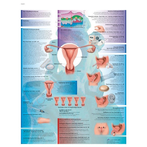 Planche anatomique Contraception - 3B Scientific