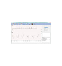 ECG PC Numérique SE-1010 Edan