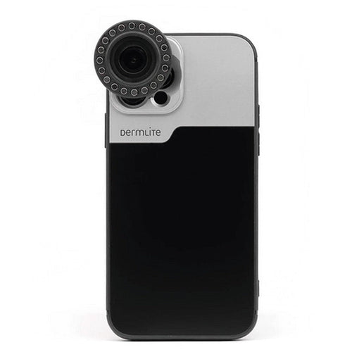 DermLite-verbindingskit voor iPhone 14 en 15 (Plus, Pro, Max)