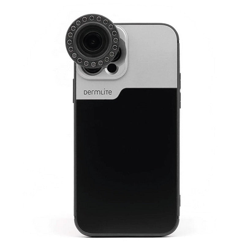 DermLite-verbindingskit voor iPhone 14 en 15 (Plus, Pro, Max)