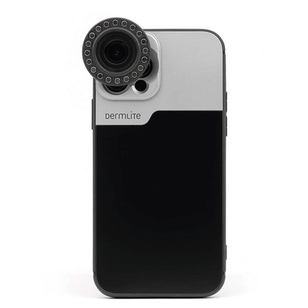 DermLite - Coque de connexion pour iPhone 16, 17 & 18