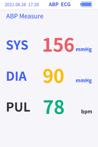 Holter EDAN met analysesoftware