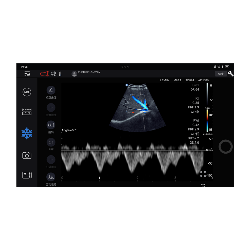 Edan Nano Convex draagbare kleuren-echografie scanner