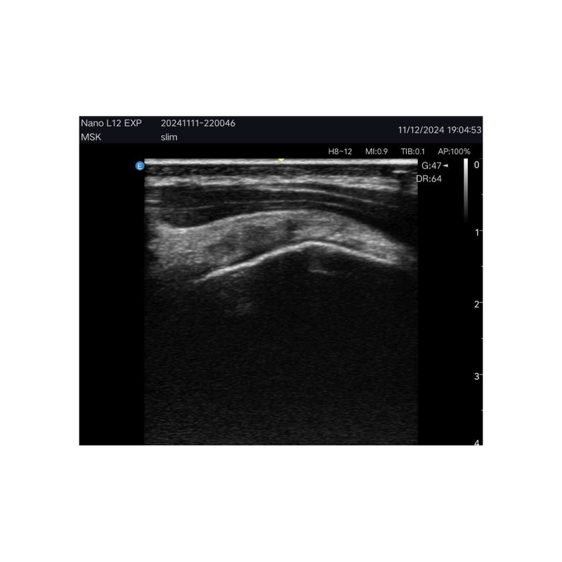 Edan Nano Lineaire Draagbare Kleuren Ultrasound Scanner