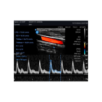 Edan Nano Lineaire Draagbare Kleuren Ultrasound Scanner