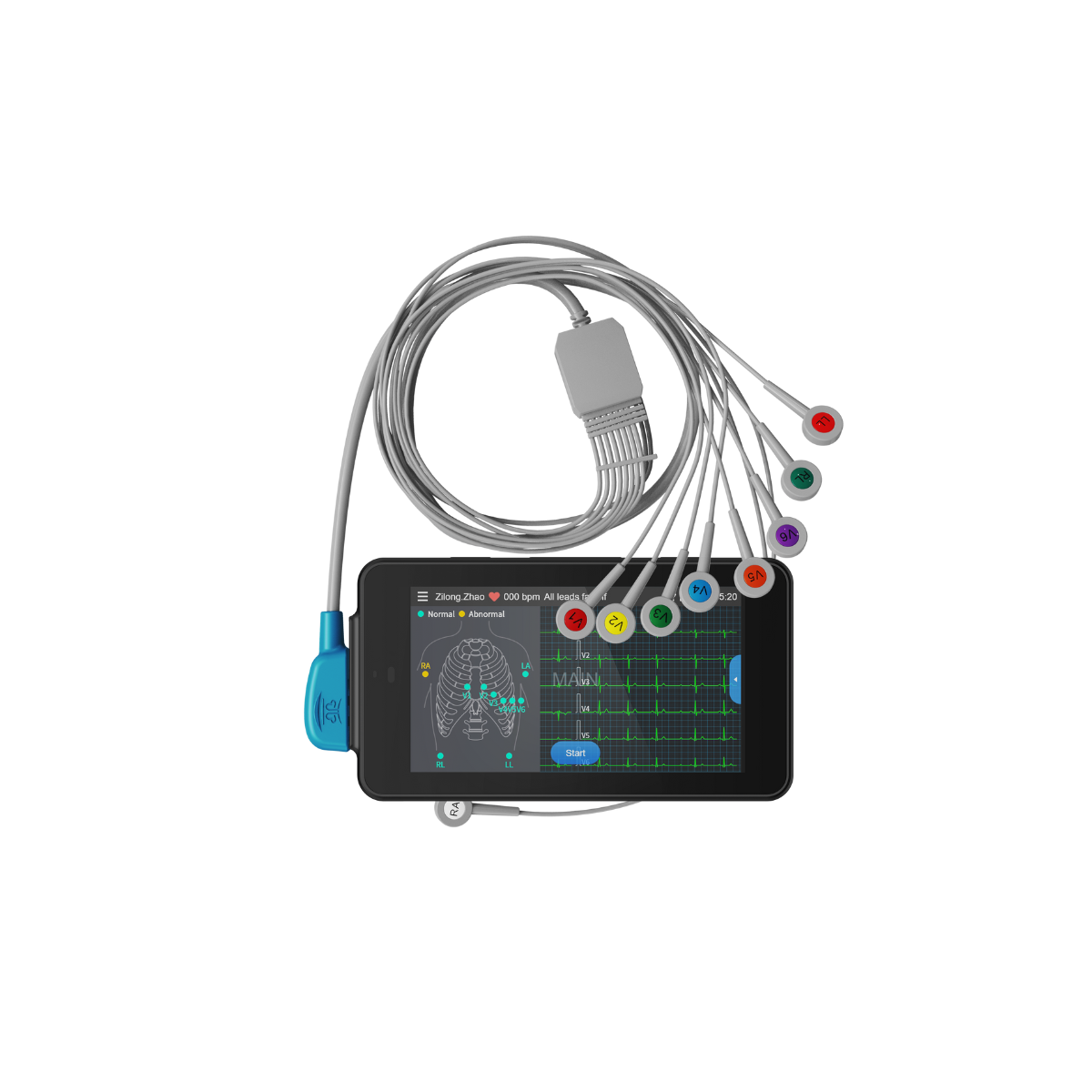 Tablette ECG de poche Cardio One Mini