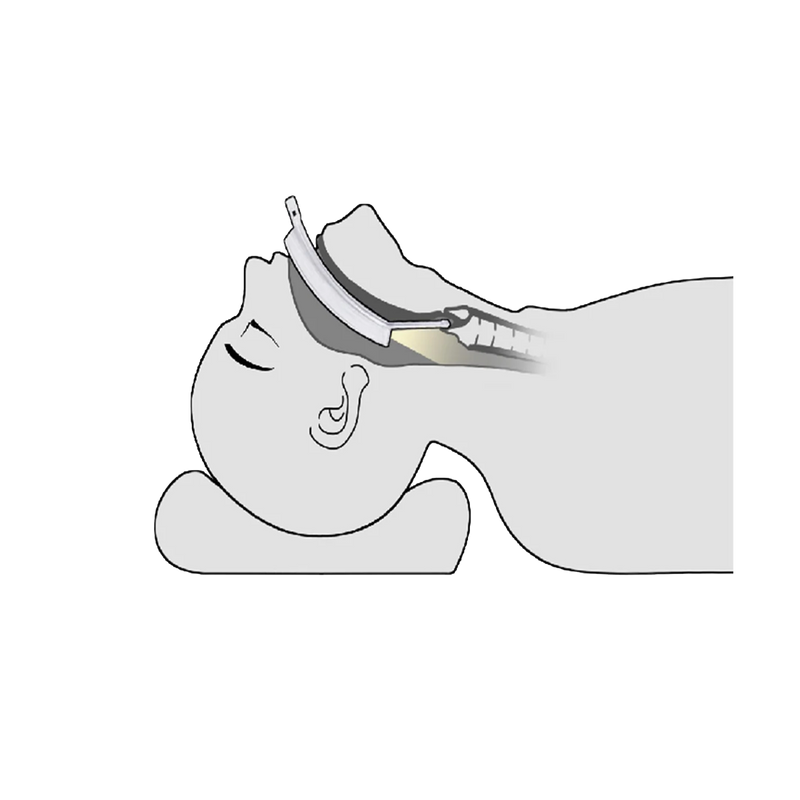 Laryngoscope vidéo LaryngoOne - One Medical