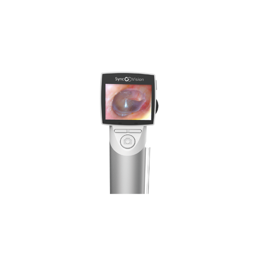 Otoscope digital avec écran, SyncVision iO1 Elite